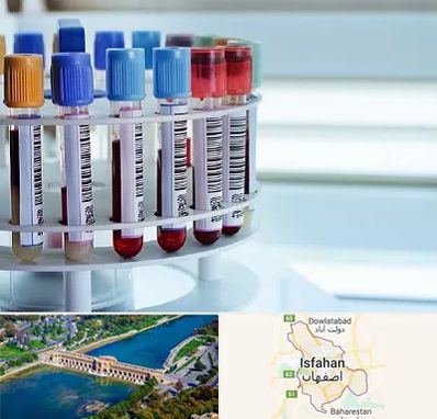 آزمایشگاه ژنتیک در اصفهان