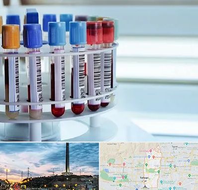 آزمایشگاه ژنتیک در منطقه 2 تهران