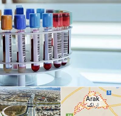 آزمایشگاه ژنتیک در اراک