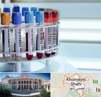 آزمایشگاه ژنتیک در خمینی شهر