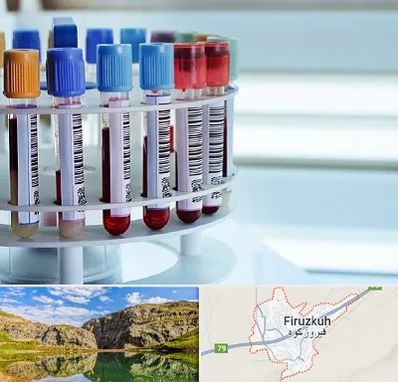 آزمایشگاه ژنتیک در فیروزکوه