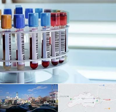 آزمایشگاه ژنتیک در ماهدشت کرج