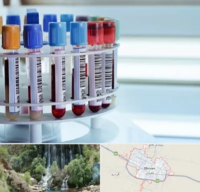 آزمایشگاه ژنتیک در شیروان