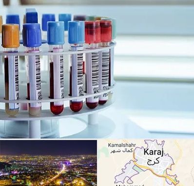 آزمایشگاه ژنتیک در کرج