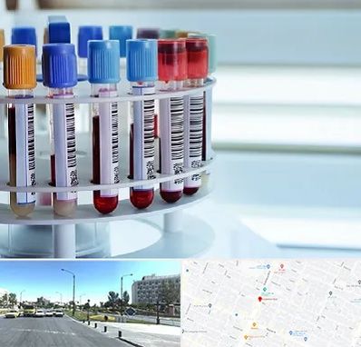 آزمایشگاه ژنتیک در بلوار کلاهدوز مشهد