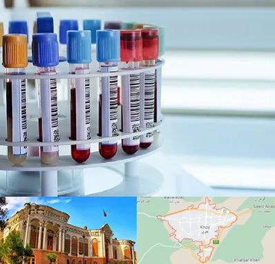 آزمایشگاه ژنتیک در خوی