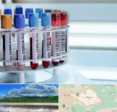 آزمایشگاه ژنتیک در مرند