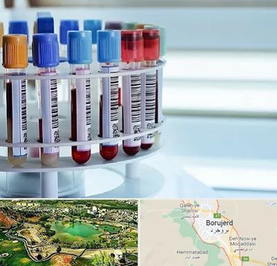 آزمایشگاه ژنتیک در بروجرد
