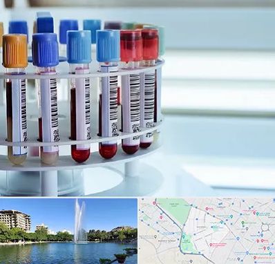 آزمایشگاه ژنتیک در کوهسنگی مشهد