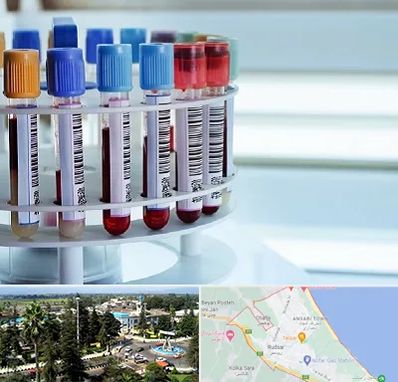 آزمایشگاه ژنتیک در رودسر