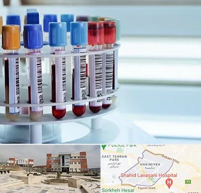 آزمایشگاه ژنتیک در حکیمیه