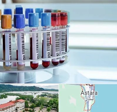 آزمایشگاه ژنتیک در آستارا