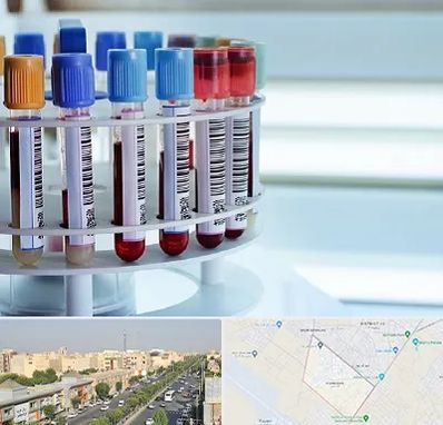 آزمایشگاه ژنتیک در کیانمهر کرج