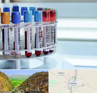 آزمایشگاه ژنتیک در کامیاران