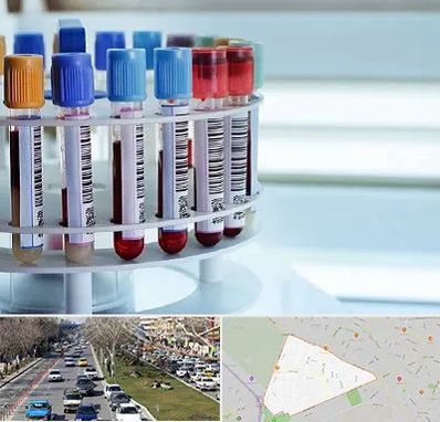 آزمایشگاه ژنتیک در احمدآباد مشهد