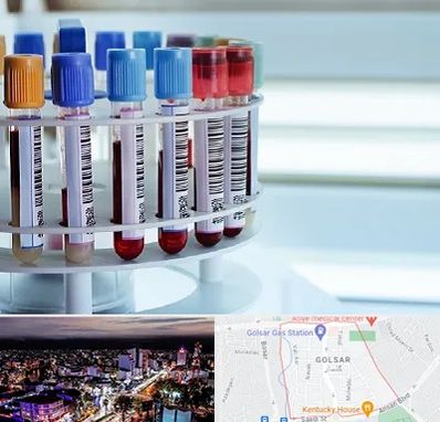 آزمایشگاه ژنتیک در گلسار رشت