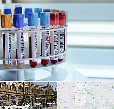 آزمایشگاه ژنتیک در منطقه 11 تهران