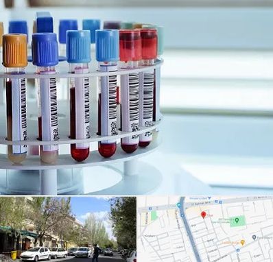 آزمایشگاه ژنتیک در کوی فیروز تبریز