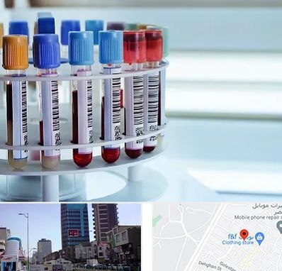 آزمایشگاه ژنتیک در چهارراه طالقانی کرج