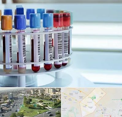 آزمایشگاه ژنتیک در کمال شهر کرج