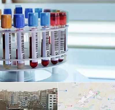 آزمایشگاه ژنتیک در محمد شهر کرج