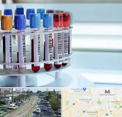 آزمایشگاه ژنتیک در جنوب تهران