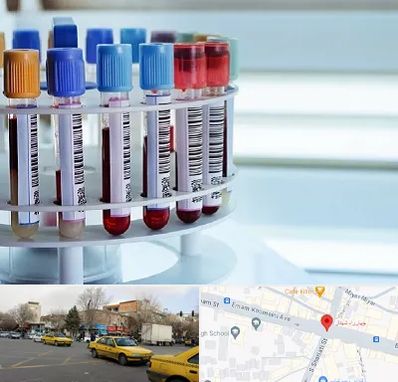 آزمایشگاه ژنتیک در شهناز تبریز