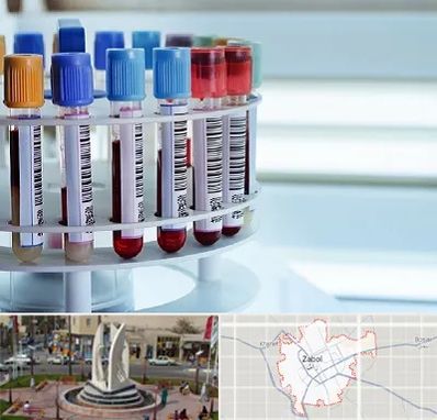 آزمایشگاه ژنتیک در زابل