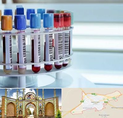 آزمایشگاه ژنتیک در سمنان