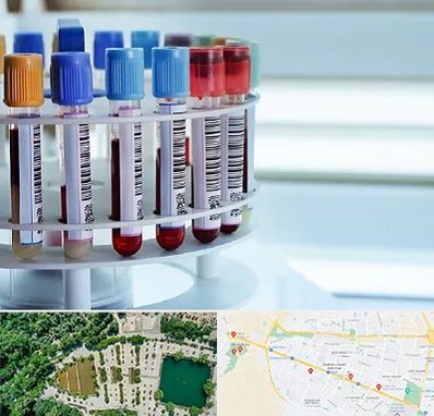 آزمایشگاه ژنتیک در وکیل آباد مشهد