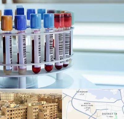 آزمایشگاه ژنتیک در جنوب غرب تهران