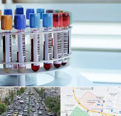 آزمایشگاه ژنتیک در گلشهر کرج