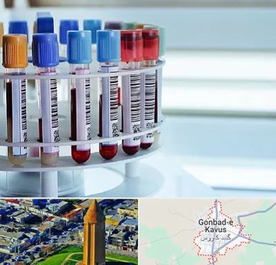 آزمایشگاه ژنتیک در گنبد کاووس