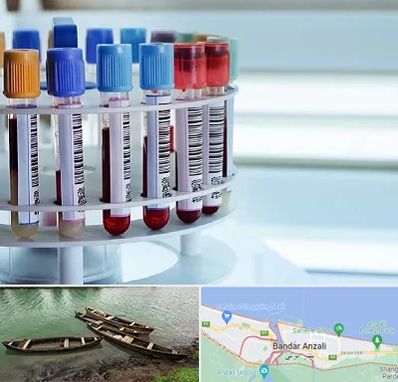 آزمایشگاه ژنتیک در بندر انزلی