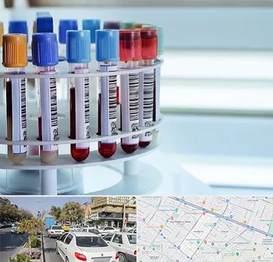 آزمایشگاه ژنتیک در مفتح مشهد