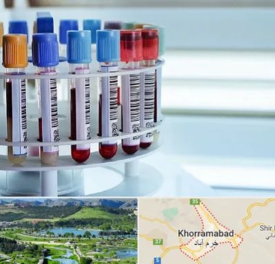 آزمایشگاه ژنتیک در خرم آباد