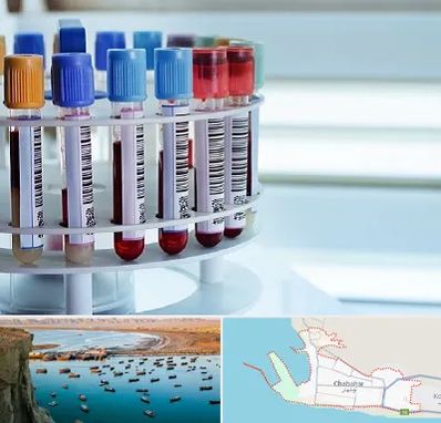 آزمایشگاه ژنتیک در چابهار