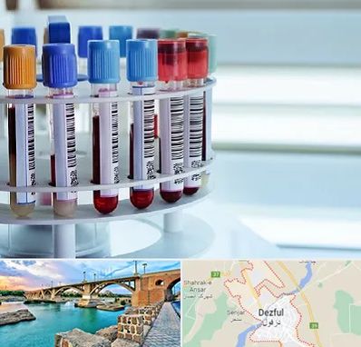 آزمایشگاه ژنتیک در دزفول