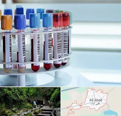 آزمایشگاه ژنتیک در علی آباد کتول