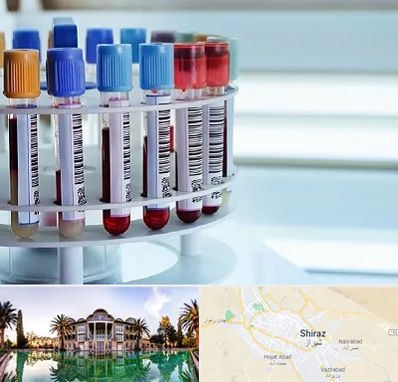 آزمایشگاه ژنتیک در شیراز