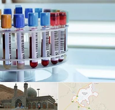 آزمایشگاه ژنتیک در شهرضا