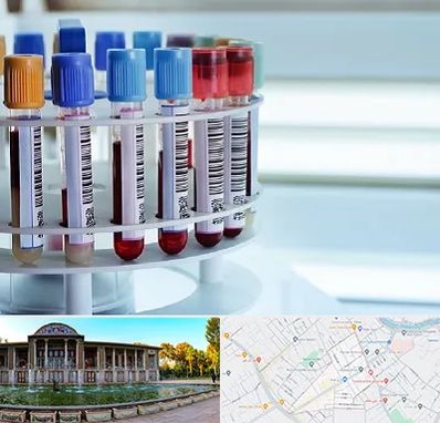 آزمایشگاه ژنتیک در عفیف آباد شیراز