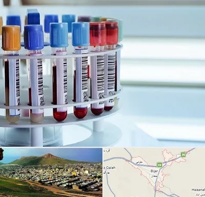آزمایشگاه ژنتیک در بیجار