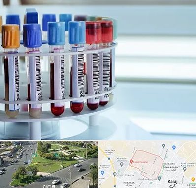 آزمایشگاه ژنتیک در شاهین ویلا کرج