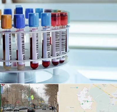 آزمایشگاه ژنتیک در نظرآباد کرج