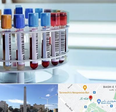 آزمایشگاه ژنتیک در فلکه گاز شیراز