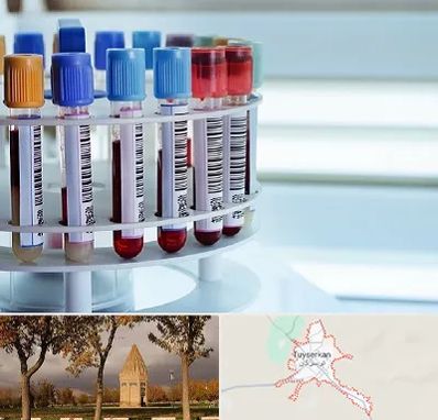 آزمایشگاه ژنتیک در تویسرکان