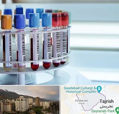 آزمایشگاه ژنتیک در زعفرانیه