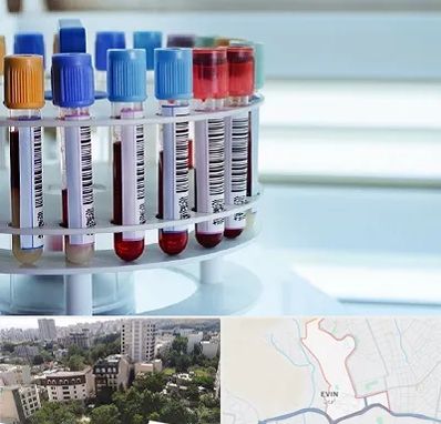 آزمایشگاه ژنتیک در اوین