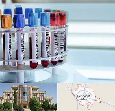 آزمایشگاه ژنتیک در دهدشت